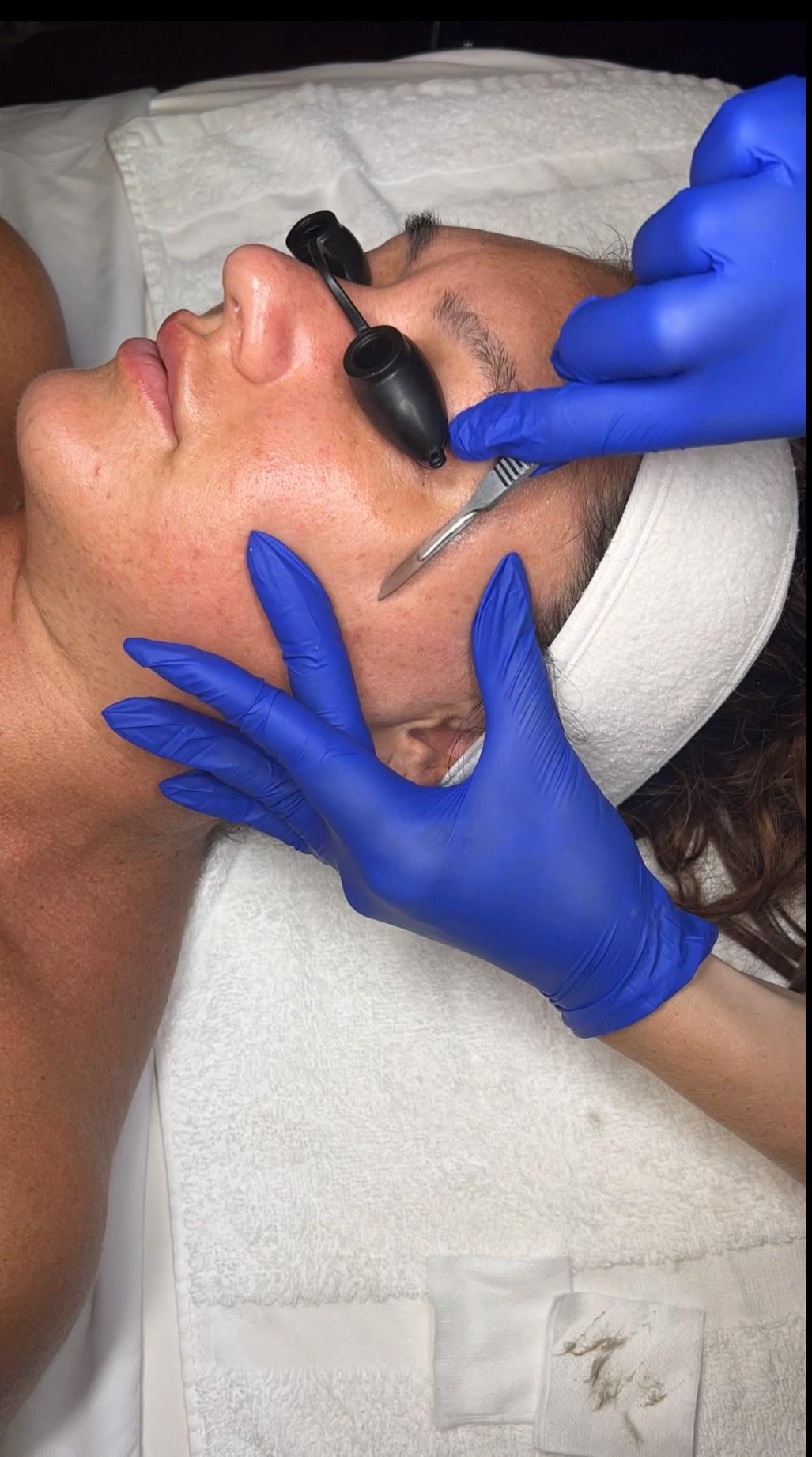 Does Dermaplaning Make Hair Gr, cover — The Bronze Lily, St. Petersburg, FL